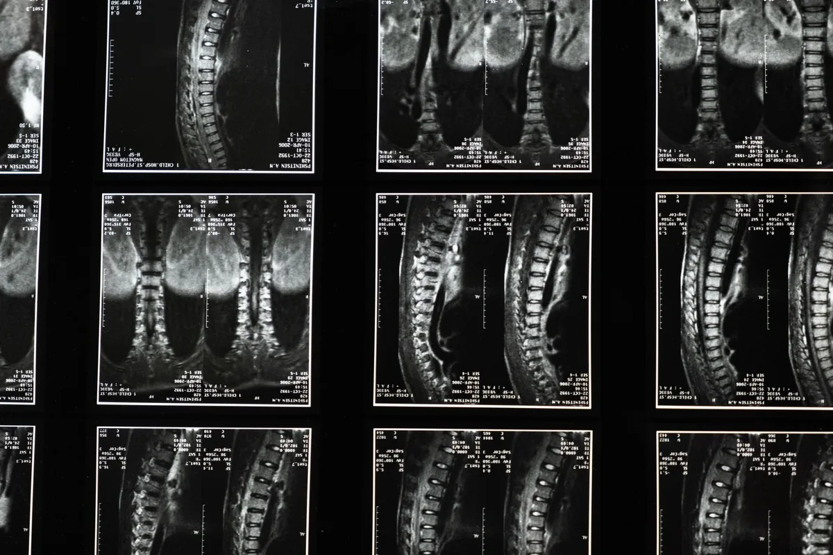 Imagerie médicale de la colonne vertébrale